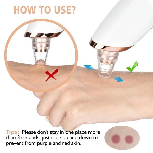 Advanced USB Rechargeable Blackhead & Pore Vacuum Cleaner – De Sleutel Tot Schone, Stralende Huid ✨💖